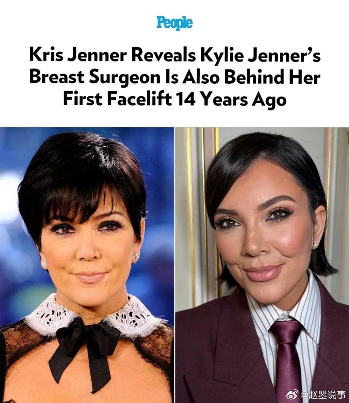 _肯达尔詹娜卡戴珊_詹娜卡戴珊