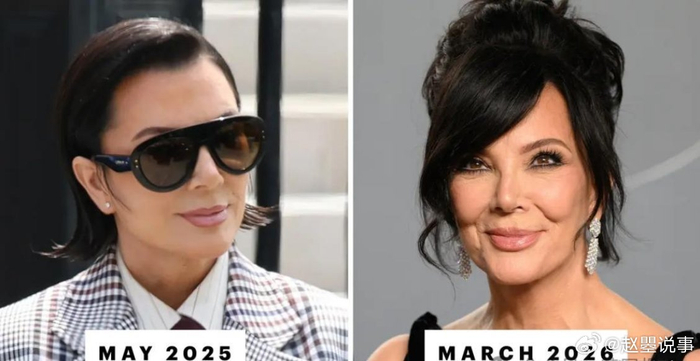 肯达尔詹娜卡戴珊__詹娜卡戴珊