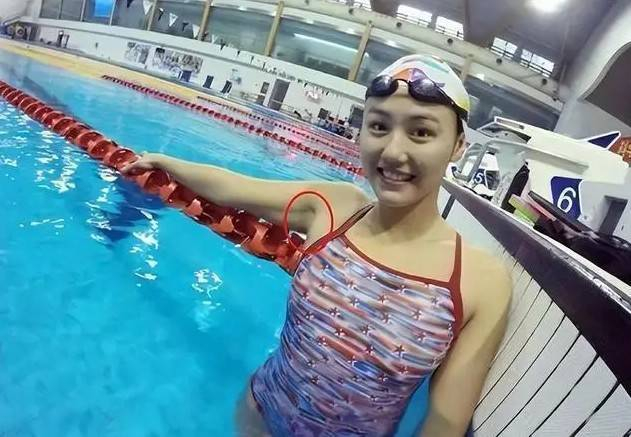 隐私毛可以剪掉吗__隐私的部位毛发能剪吗