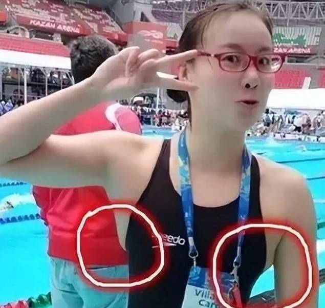 隐私的部位毛发能剪吗_隐私毛能剪掉吗_